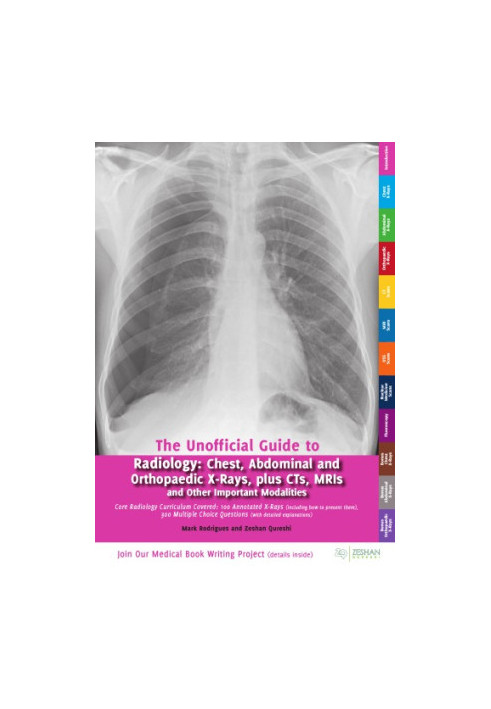 The Unofficial Guide to Radiology: Chest, Abdominal, Orthopaedic X Rays, plus CTs, MRIs and Other Important Modalities