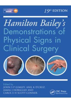 Hamilton Bailey's Physical Signs: Demonstrations of Physical Signs in Clinical Surgery