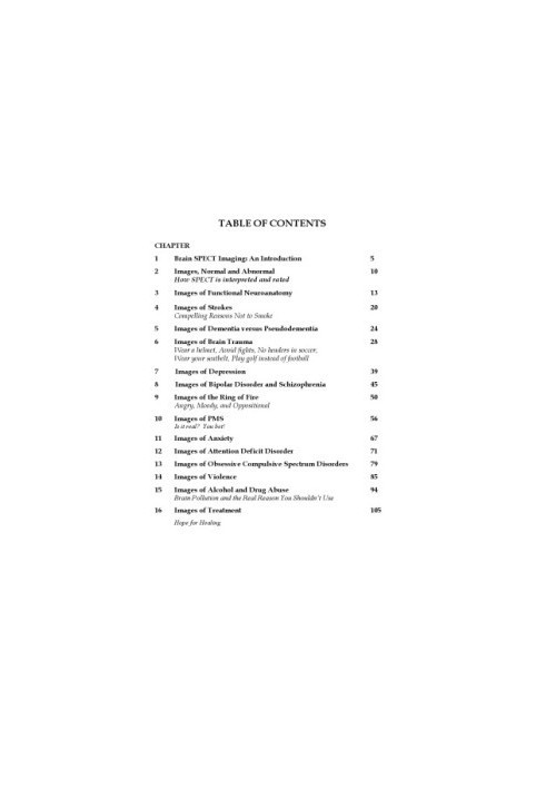 Images of Human Behavior A Brain SPECT Atlas
