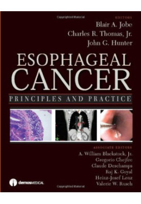 Esophageal Cancer: Principles and Practice