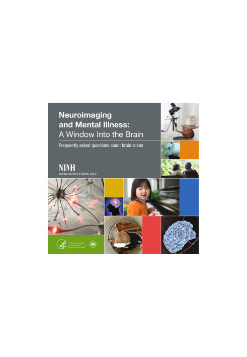 Neuroimaging and Mental Illness: A Window Into the Brain