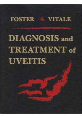 Diagnosis and Treatment of Uveitis