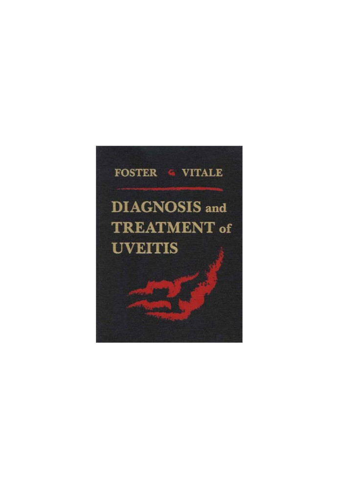 Diagnosis and Treatment of Uveitis