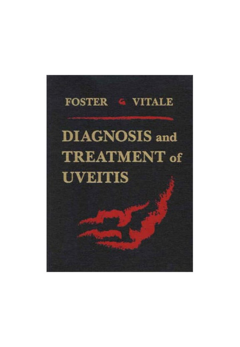 Diagnosis and Treatment of Uveitis