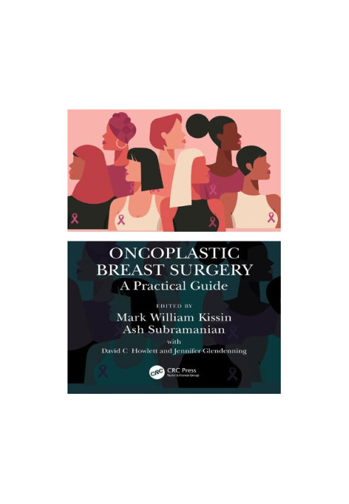 Oncoplastic Breast Surgery: A Practical Guide