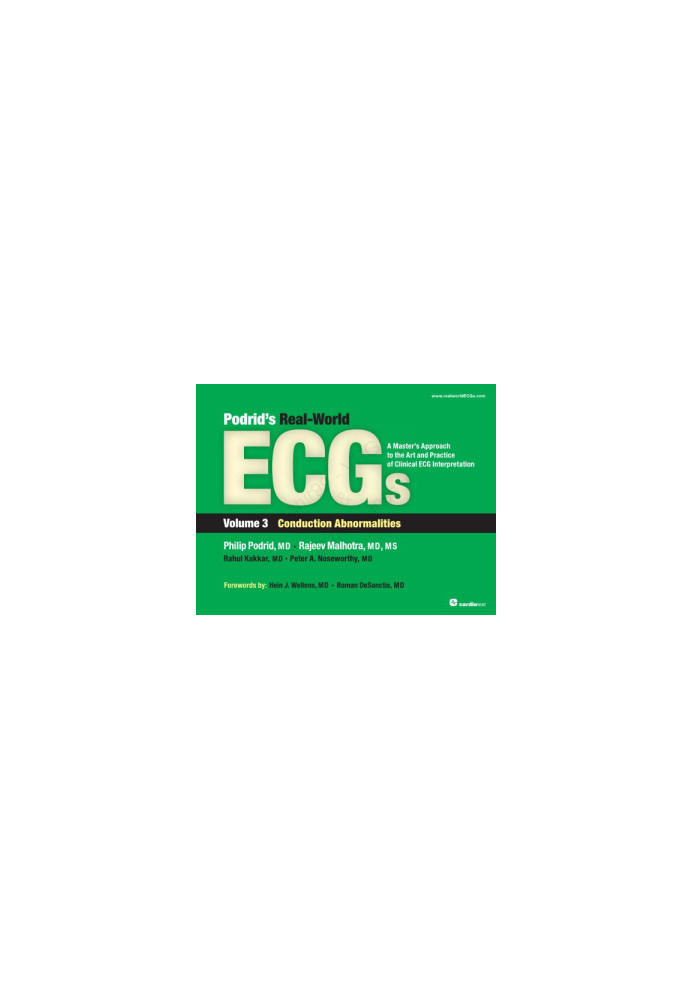 Podrid’s Real-World ECGs : A Master’s Approach to the Art and Practice of Clinical ECG Interpretation - Volume 3 - Conduction