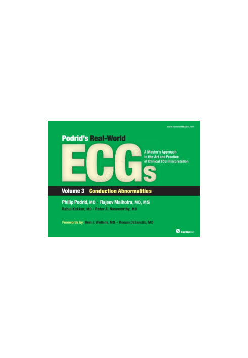 Podrid’s Real-World ECGs : A Master’s Approach to the Art and Practice of Clinical ECG Interpretation - Volume 3 - Conduction