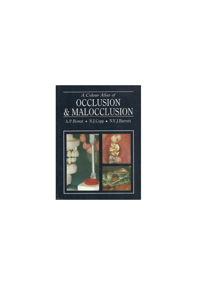 A Colour Atlas of Occlusion and Malocclusion
