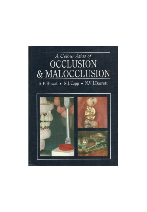 A Colour Atlas of Occlusion and Malocclusion