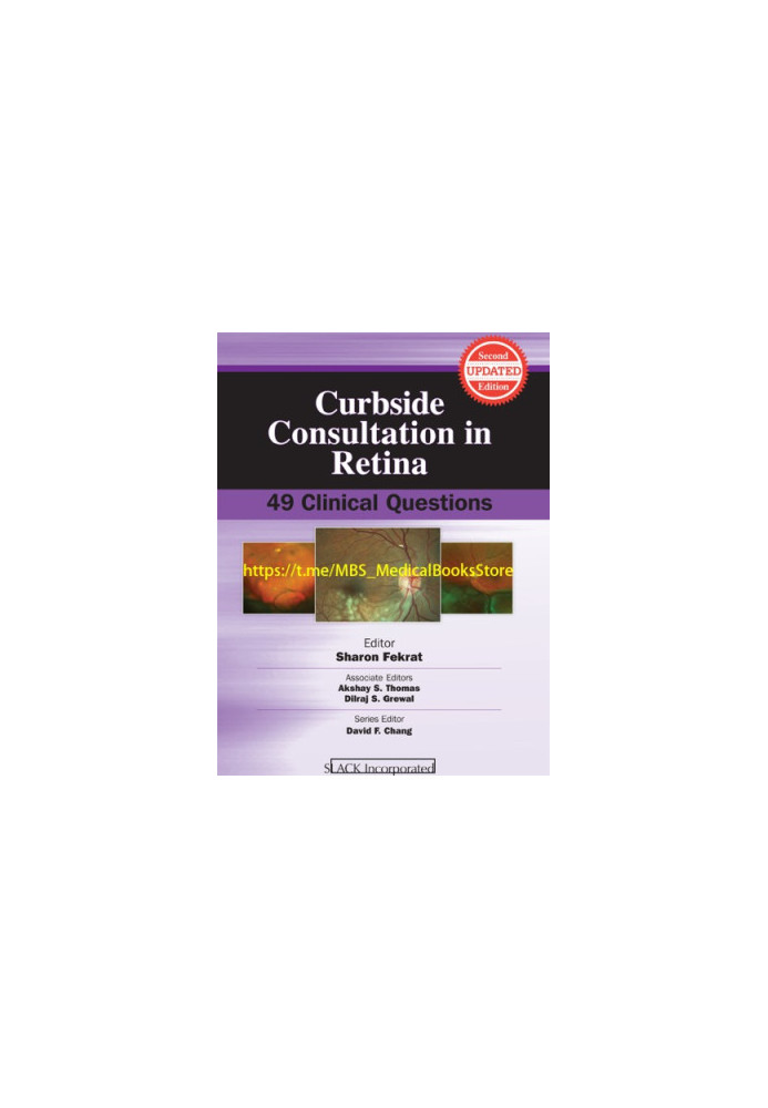Curbside Consultation in Retina: 49 Clinical Questions