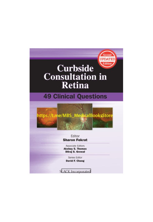 Curbside Consultation in Retina: 49 Clinical Questions