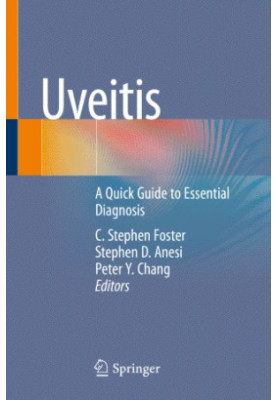 Uveitis: A Quick Guide to Essential Diagnosis