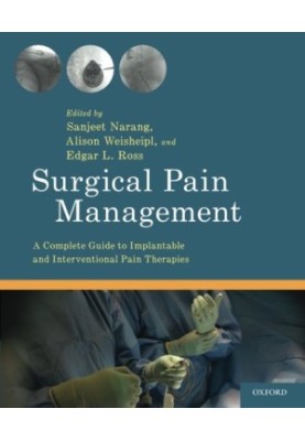 Surgical Pain Management: A Complete Guide to Implantable and Interventional Pain Therapies