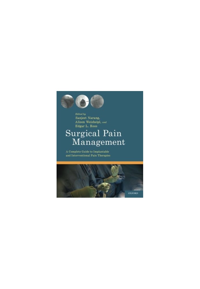 Surgical Pain Management: A Complete Guide to Implantable and Interventional Pain Therapies