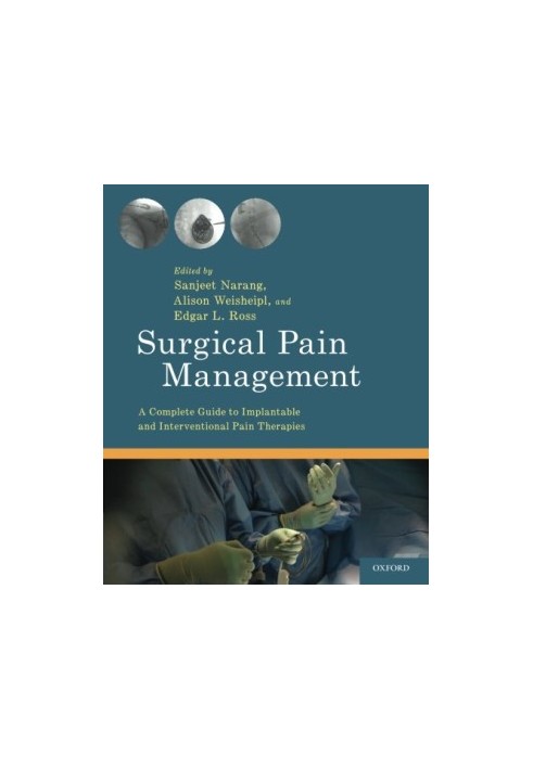 Surgical Pain Management: A Complete Guide to Implantable and Interventional Pain Therapies