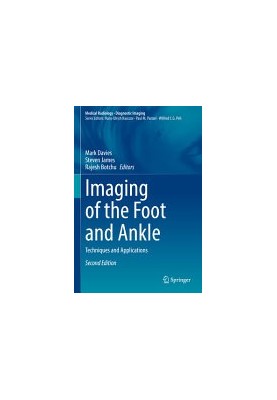 Imaging of the Foot and Ankle: Techniques and Applications, 2nd