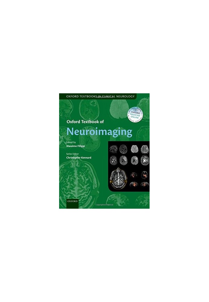 Oxford textbook of neuroimaging