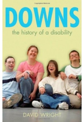 Down's Syndrome: The Biography (Biographies of Diseases)