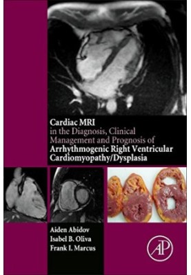 The cardiac MRI in diagnosis, clinical management, and prognosis of arrhythmogenic right ventricular cardiomyopathy/dysplasia