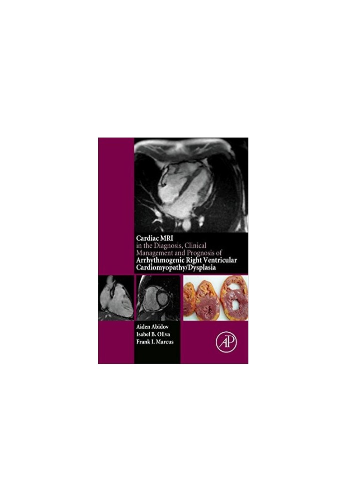 The cardiac MRI in diagnosis, clinical management, and prognosis of arrhythmogenic right ventricular cardiomyopathy/dysplasia