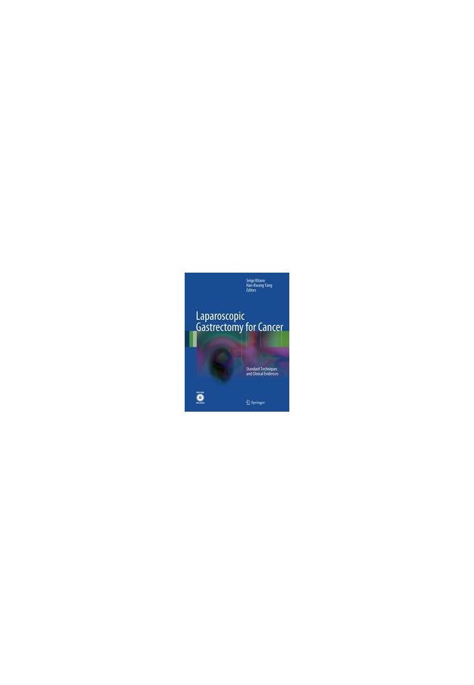 Laparoscopic Gastrectomy for Cancer: Standard Techniques and Clinical Evidences