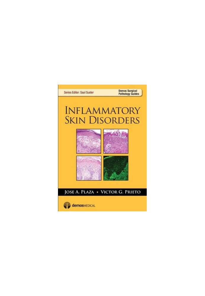 Inflammatory Skin Disorders