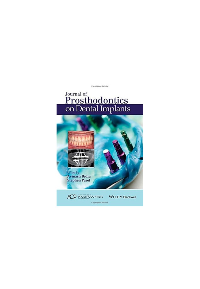 Journal of Prosthodontics on Dental Implants
