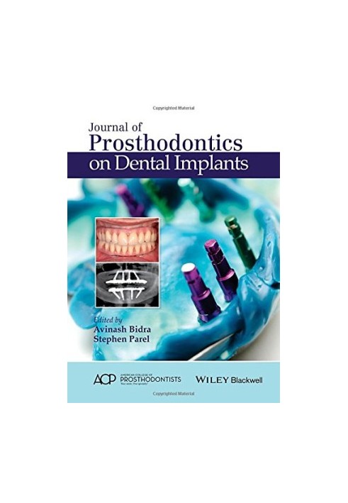 Journal of Prosthodontics on Dental Implants