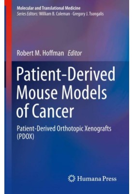 Patient-Derived Mouse Models of Cancer : Patient-Derived Orthotopic Xenografts (PDOX)