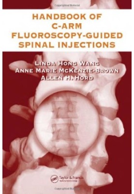 The Handbook of C-Arm Fluoroscopy-Guided Spinal Injections