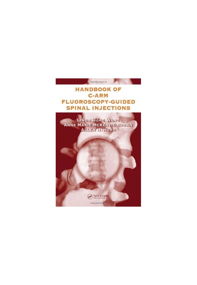 The Handbook of C-Arm Fluoroscopy-Guided Spinal Injections
