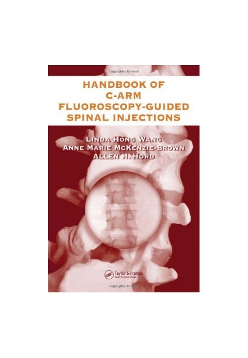 The Handbook of C-Arm Fluoroscopy-Guided Spinal Injections