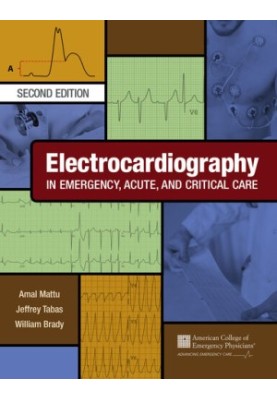 Electrocardiography in Emergency, Acute, and Critical Care