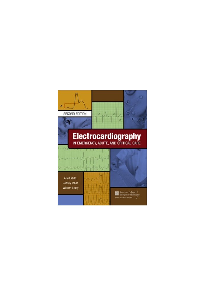 Electrocardiography in Emergency, Acute, and Critical Care