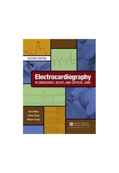 Electrocardiography in Emergency, Acute, and Critical Care