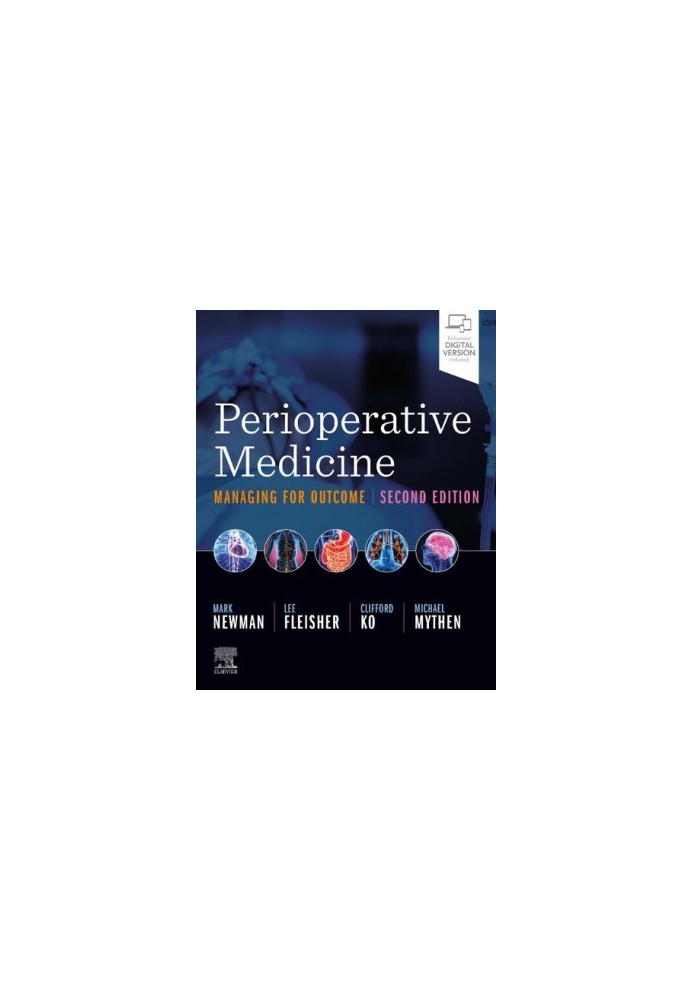 Perioperative Medicine: Managing for Outcome 2nd Edition