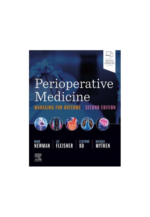 Perioperative Medicine: Managing for Outcome 2nd Edition
