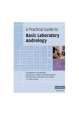 A practical guide to basic laboratory andrology