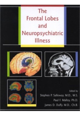 The Frontal Lobes and Neuropsychiatric Illness