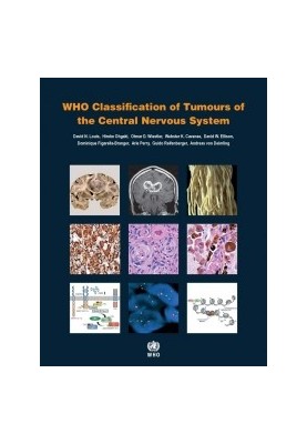 WHO Classification of Tumours of the Central Nervous System