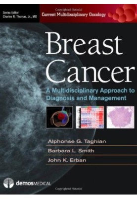 Breast Cancer: A Multidisciplinary Approach to Diagnosis and Managmenet (Current Multidisciplinary Oncology Series)