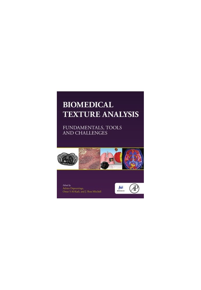 Biomedical Texture Analysis: Fundamentals, Tools and Challenges