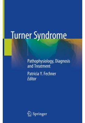 Turner Syndrome: Pathophysiology, Diagnosis and Treatment