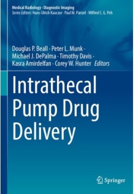 Intrathecal Pump Drug Delivery
