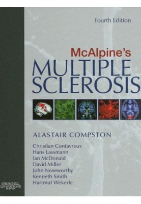 McAlpine's Multiple Sclerosis
