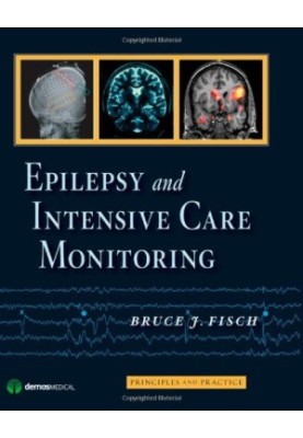 Epilepsy and Intensive Care Monitoring: Principles and Practice