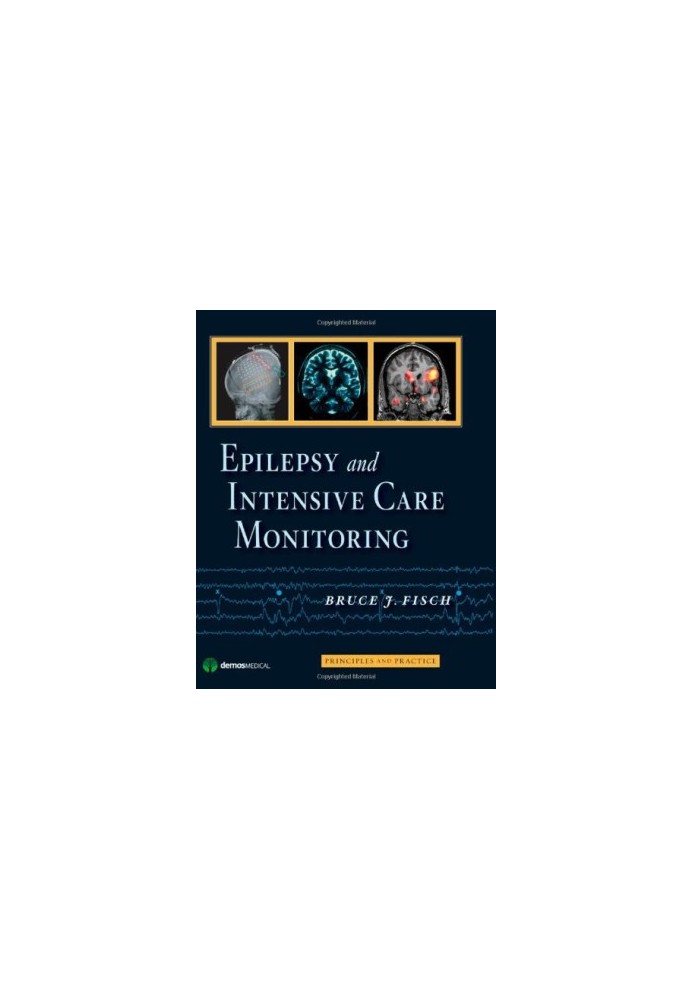 Epilepsy and Intensive Care Monitoring: Principles and Practice