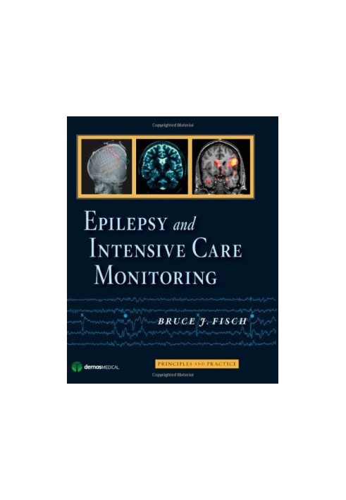 Epilepsy and Intensive Care Monitoring: Principles and Practice