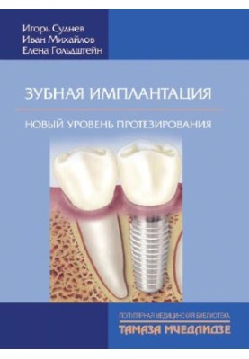 Зубная имплантация. Новый уровень протезирования