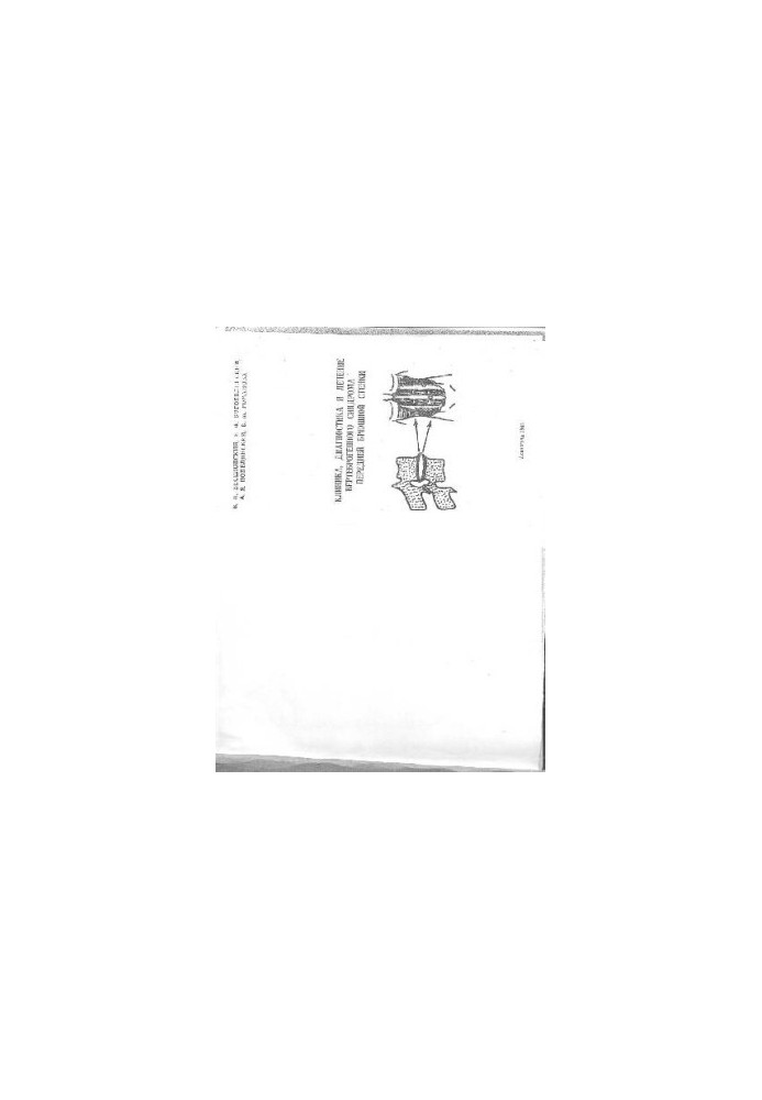 Clinic, diagnostics and treatment of vertebrogenic abdominal wall syndrome